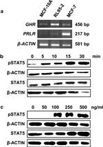 Phospho-STAT5 alpha (Tyr694) Antibody in Western Blot (WB)