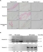 Tenascin C Antibody in Western Blot (WB)