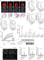 Fibronectin Antibody in Immunohistochemistry (IHC)