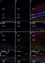 TIMP3 Antibody in Immunohistochemistry (IHC)