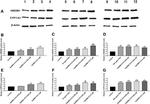 HSD3B1 Antibody in Western Blot (WB)