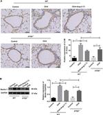 LC3B Antibody in Immunohistochemistry (IHC)