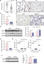 beta-2 Adrenergic Receptor Antibody in Western Blot (WB)