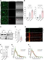 FMRP Antibody in Western Blot, Immunoprecipitation (WB, IP)