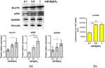 GLUT4 Antibody in Western Blot (WB)