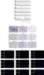 FBXO5 Antibody in Immunohistochemistry (IHC)