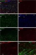 IBA1 Antibody in Immunohistochemistry (IHC)