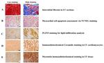 OXPAT Antibody in Immunohistochemistry (IHC)