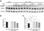 Phospho-CaMKII beta/gamma/delta (Thr287) Antibody in Western Blot (WB)