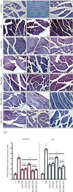 MURF1 Antibody in Immunohistochemistry (IHC)