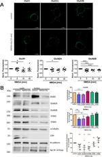 NMDAR1 Antibody in Western Blot (WB)