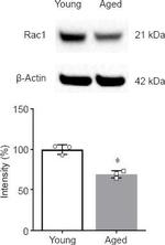 RAC1 Antibody in Western Blot (WB)