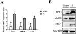 TPT1 Antibody in Western Blot (WB)