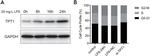 TPT1 Antibody in Western Blot (WB)
