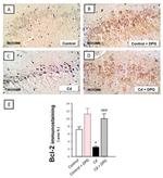 Bcl-2 Antibody in Immunohistochemistry (IHC)