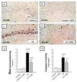 Bax Antibody in Immunohistochemistry (IHC)