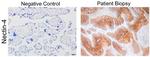 Nectin 4 Antibody in Immunohistochemistry (IHC)