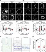 VE-cadherin Antibody in Immunohistochemistry (IHC)