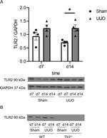 TLR2 Antibody in Western Blot (WB)