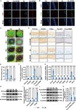 N-cadherin Antibody in Immunohistochemistry (IHC)