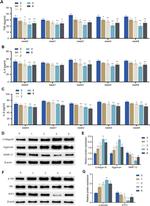 Aggrecan Antibody in Western Blot (WB)