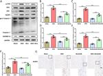 GSDMD Antibody in Western Blot (WB)