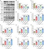 GSDMD Antibody in Western Blot (WB)