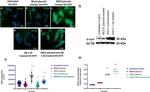 alpha Synuclein Antibody in Western Blot (WB)