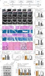 PIK3R2 Antibody in Western Blot (WB)