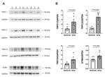 STIM1 Antibody in Western Blot (WB)