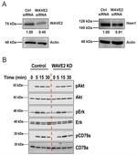 WAVE2 Antibody in Western Blot (WB)