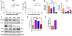 Endothelin A Receptor Antibody in Western Blot (WB)