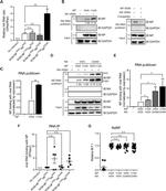 Influenza A H1N1 NA Antibody in Western Blot (WB)