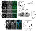 TFEB Antibody in Immunocytochemistry (ICC/IF)