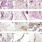 SARS/SARS-CoV-2 Spike Protein S2 Antibody in Immunohistochemistry (IHC)