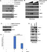 Epstein Barr Virus p18 Polyclonal Antibody