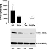 OPRM1 Antibody in Western Blot (WB)