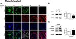 PCSK9 Antibody in Western Blot (WB)