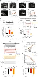 HCN1 Antibody in Western Blot (WB)