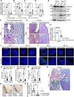 VEGF Antibody in Western Blot (WB)