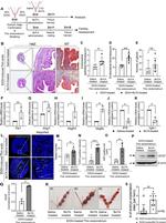 VEGF Antibody in Western Blot (WB)