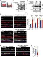 Klebsiella pneumoniae Polyclonal Antibody