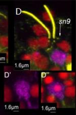 Mouse IgG (H+L) Cross-Adsorbed Secondary Antibody in Immunohistochemistry (IHC)