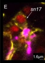 Rabbit IgG (H+L) Cross-Adsorbed Secondary Antibody in Immunohistochemistry (IHC)