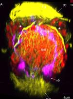 Rabbit IgG (H+L) Cross-Adsorbed Secondary Antibody in Immunohistochemistry (IHC)