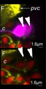Mouse IgG (H+L) Cross-Adsorbed Secondary Antibody in Immunohistochemistry (IHC)