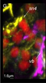 Rabbit IgG (H+L) Cross-Adsorbed Secondary Antibody in Immunohistochemistry (IHC)