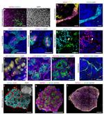 PAX2 Antibody in Immunohistochemistry (IHC)