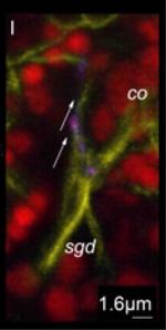 Rabbit IgG (H+L) Cross-Adsorbed Secondary Antibody in Immunohistochemistry (IHC)