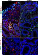 Mouse IgG (H+L) Cross-Adsorbed Secondary Antibody in Immunohistochemistry (IHC)